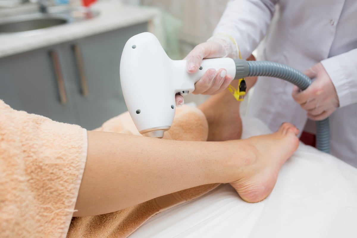 Laser Treatment at RPM Health