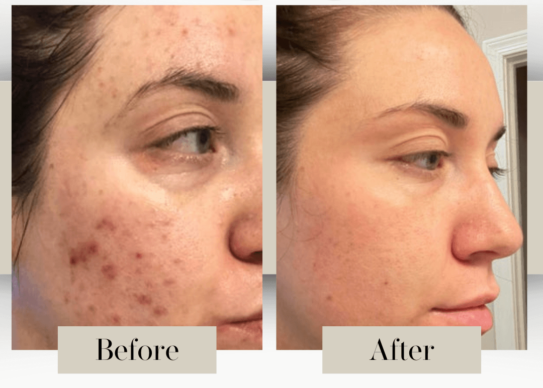 Before_and_after_7_21